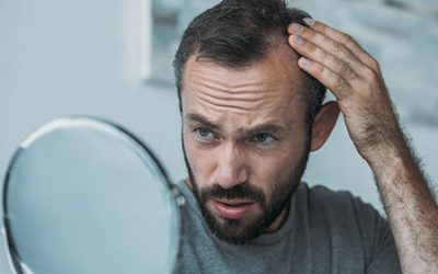 Why Is Your Hair Thinning?