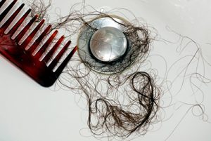 6 facts about hair loss, 6 Facts About Hair Loss You May Not Know