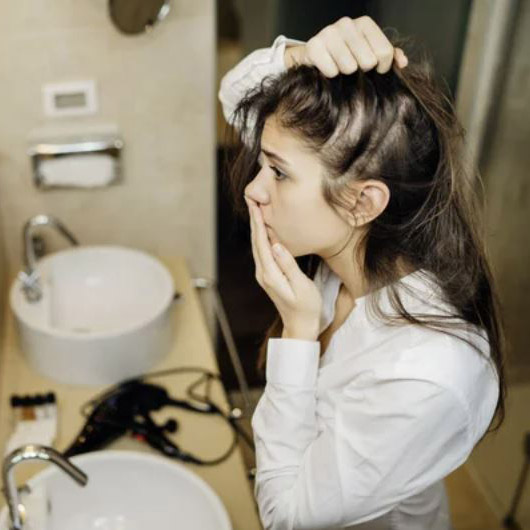 tips to reduce hair loss, Three Tips to Reduce Hair Loss