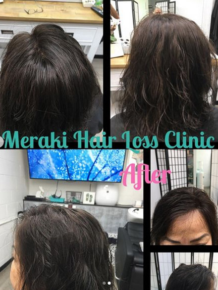 Hair Treatment Results